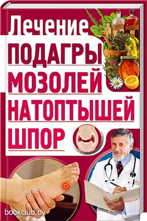 Лечение подагры, мозолей, натоптышей, шпор