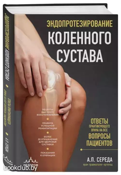 Эндопротезирование коленного сустава: ответы практикующего врача на все вопросы пациентов